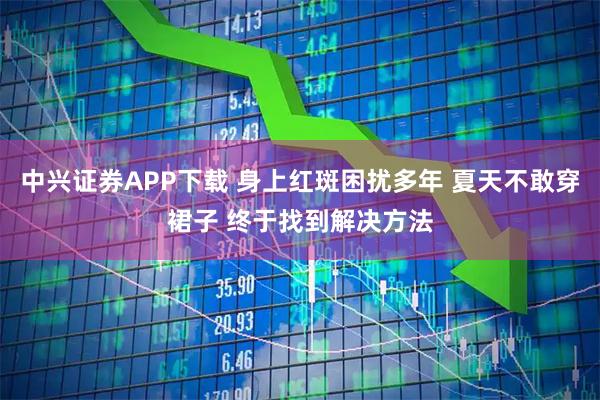 中兴证券APP下载 身上红斑困扰多年 夏天不敢穿裙子 终于找到解决方法